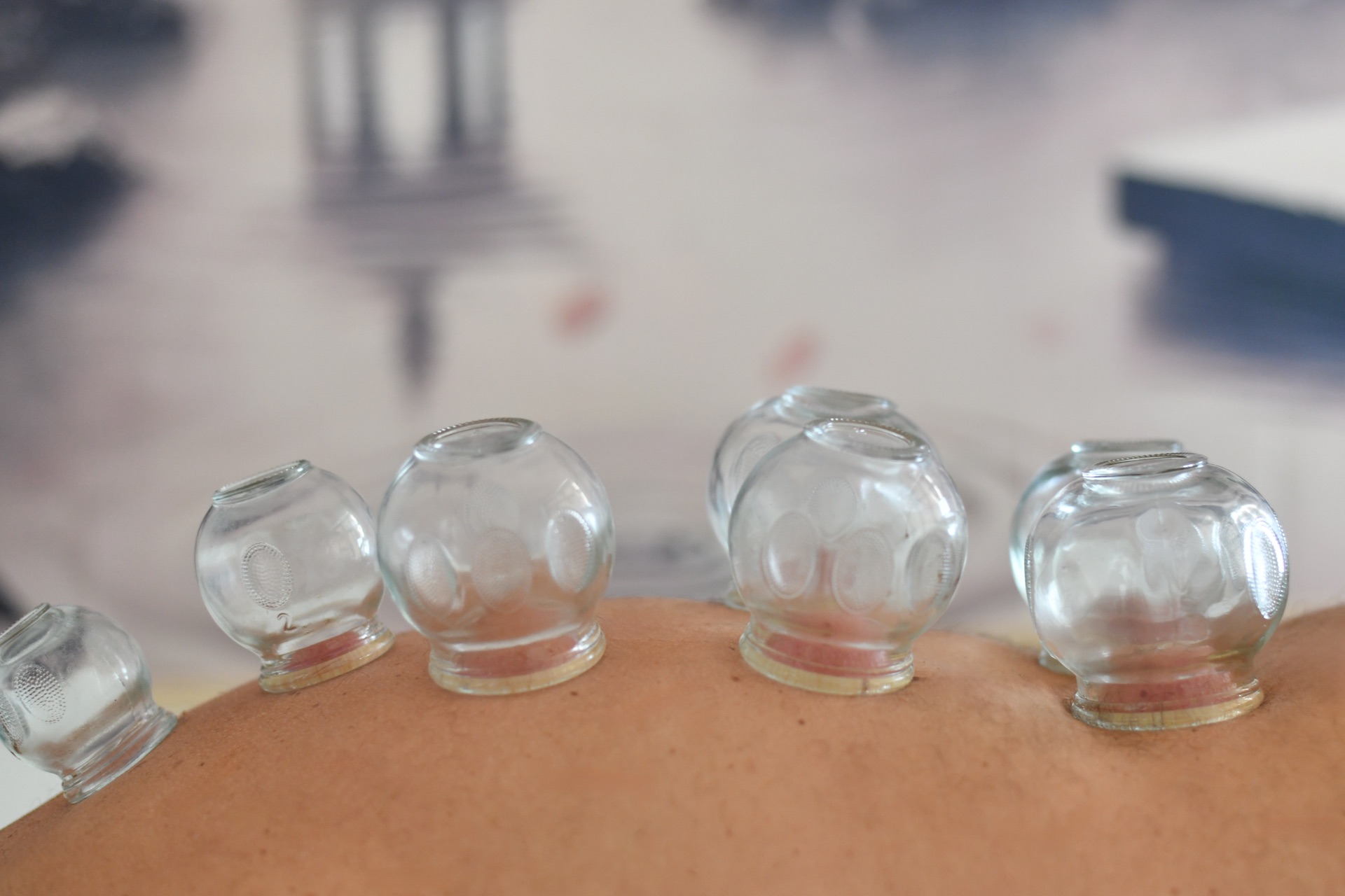 Bankovanie - terapia